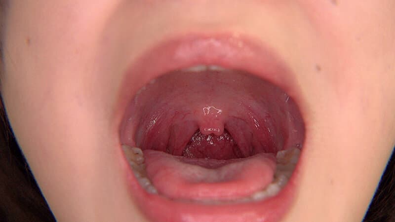 Sample image 6